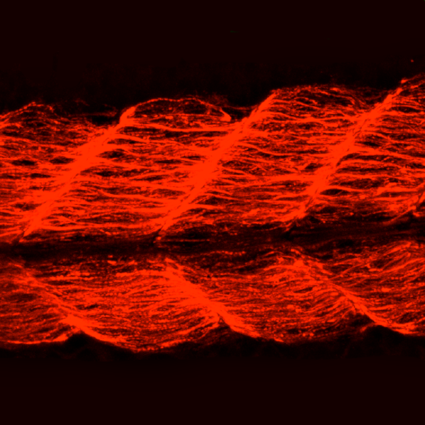 Immunofluorescent image of a 20hpf zebrafish embryo labeled with DSHB antibody EB165 against Myosin heavy chain, embryonic and adult fast. PMID: 30315160, Fig. S1D.